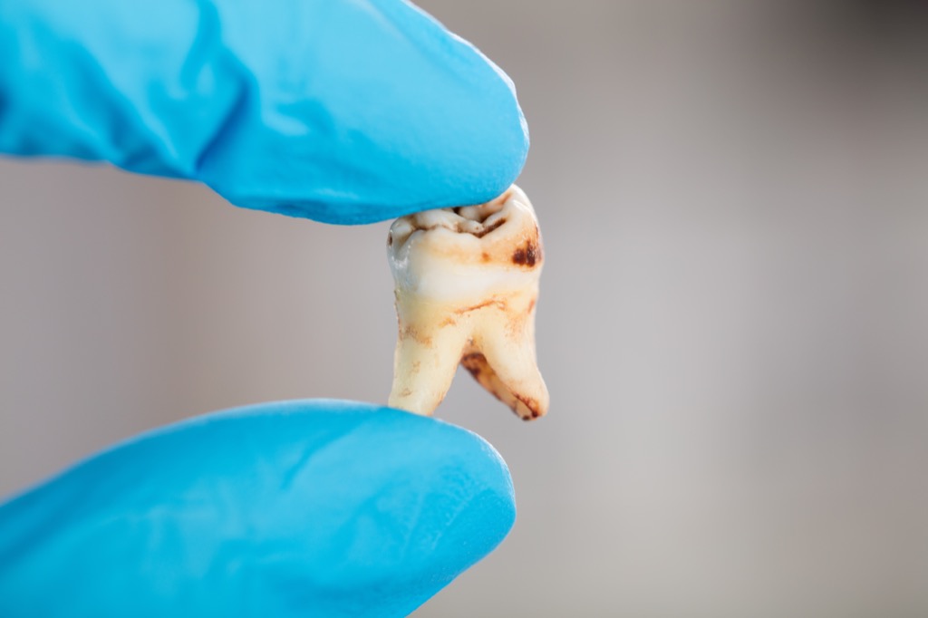 tooth decay in tooth that was removed, ways your body changes after 40