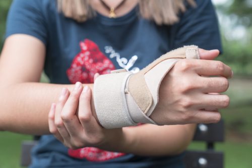 Woman with cast on wrist body changes over 40