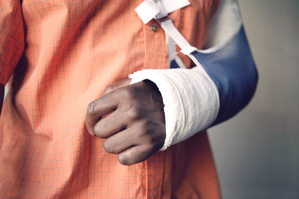 man wearing cast weird town names