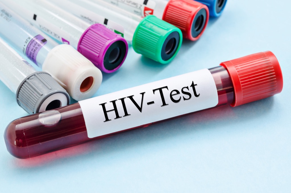 HIV blood test how people are healthier