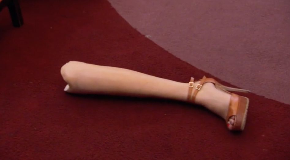 Real Housewives of New York Reality Show Prosthetic Leg