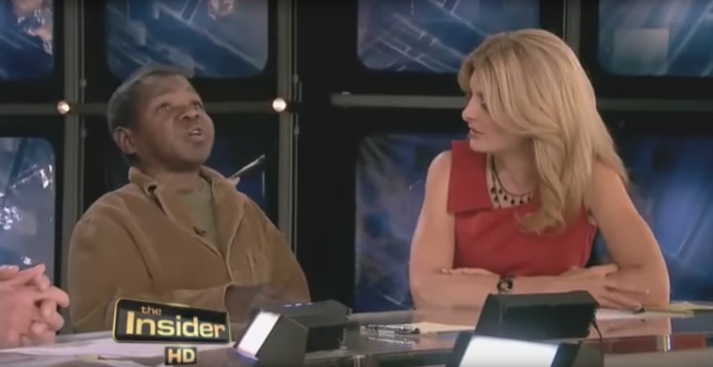 Gary Coleman Exploded Outrageous Celebrity Interview
