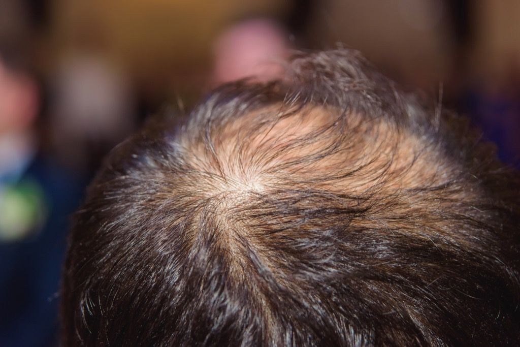 17 Surprising Signs Your Hair Will Go Gray — Best Life