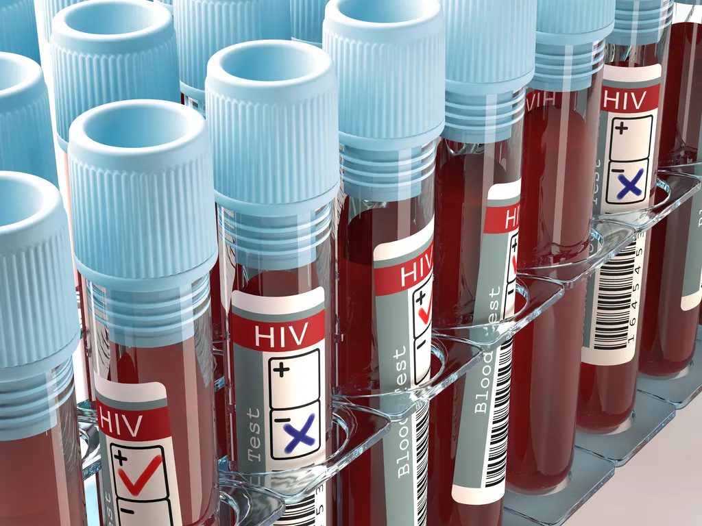 HIV Tests Scientific Discoveries