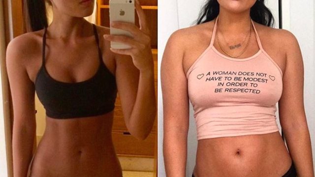 sports illustrated model shares before after photos of her eating disorder