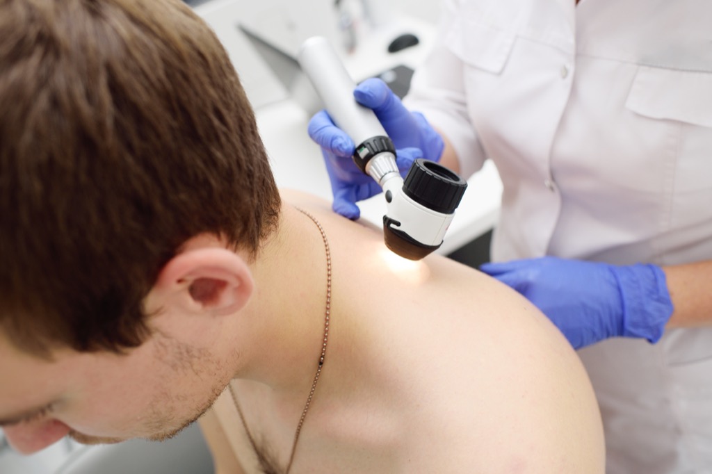 doctor checking mole skin cancer symptoms 