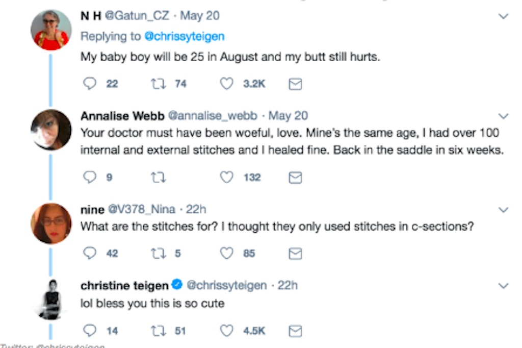 teigen gets real about giving birth