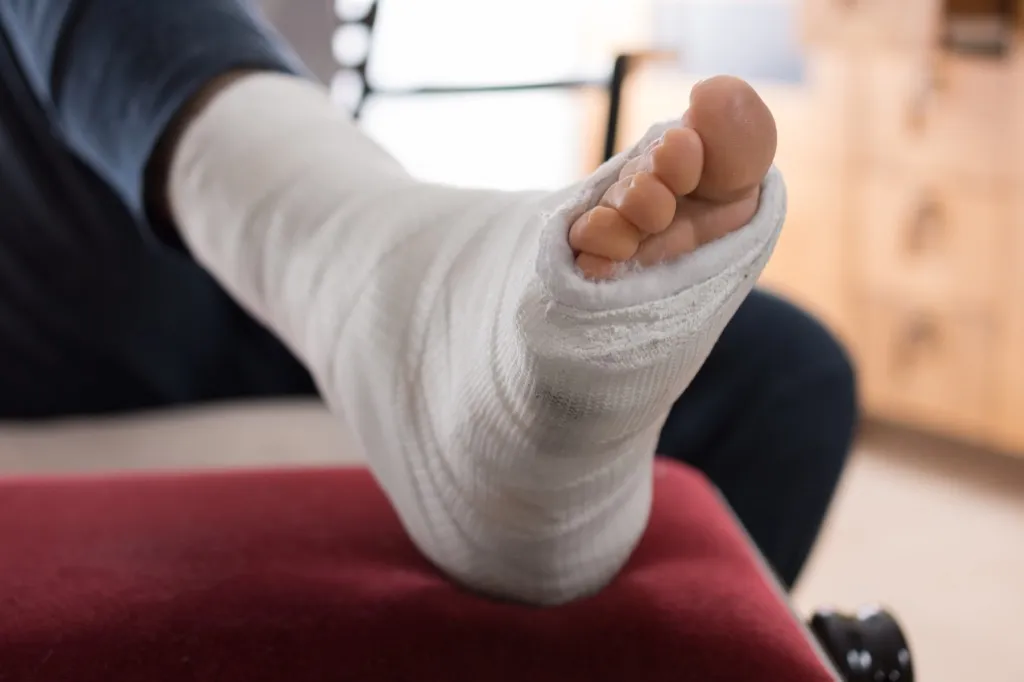 broken foot cast 27 Insane Things Astronauts Have to Do