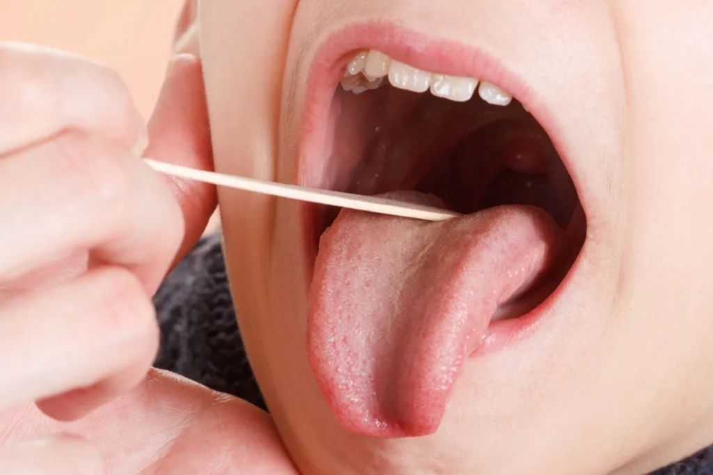 Swollen tongue, doctor {Allergy Symptoms}
