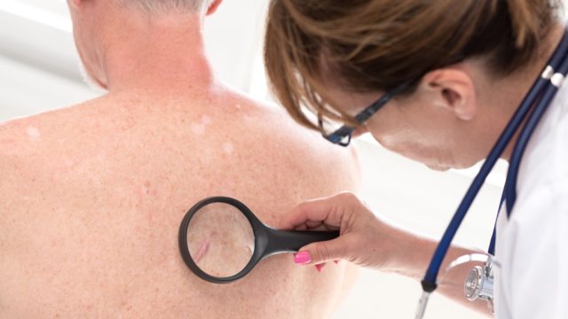 doctor examines man's back, things men should know about health after 40