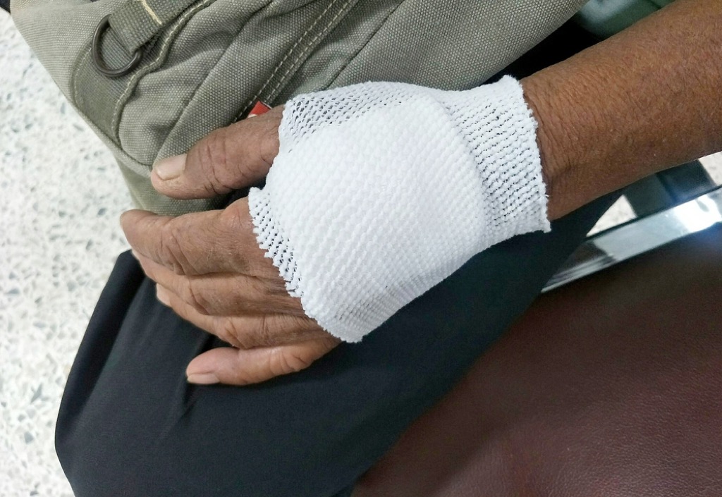 man with injured hand