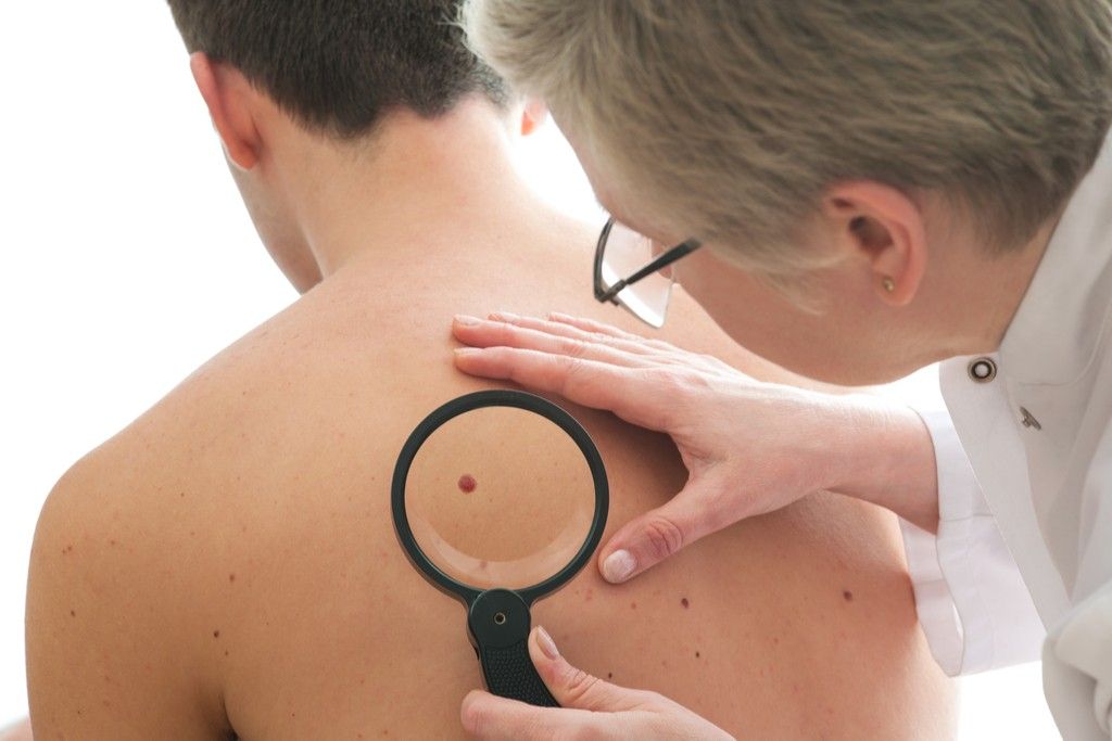 Skin Cancer, skin cancer facts