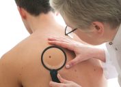 Skin Cancer, skin cancer facts