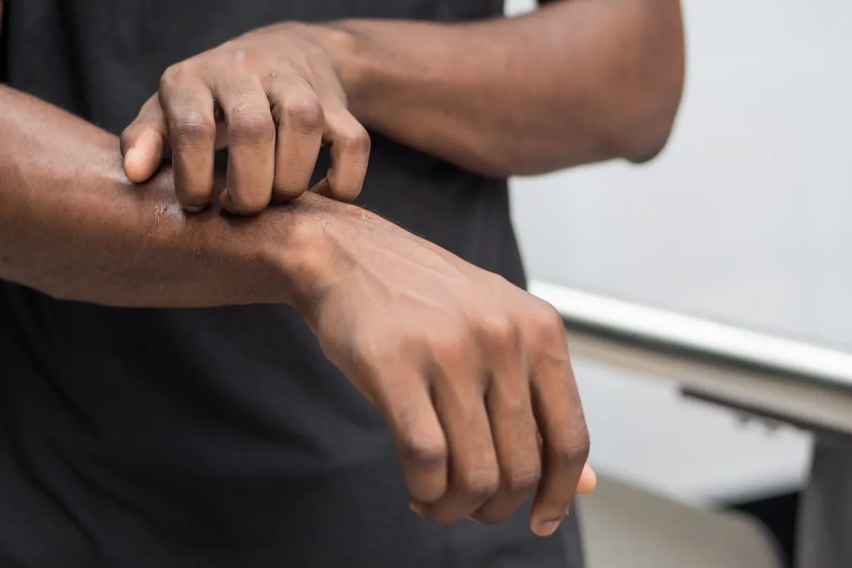 black man itches arm, skin cancer facts