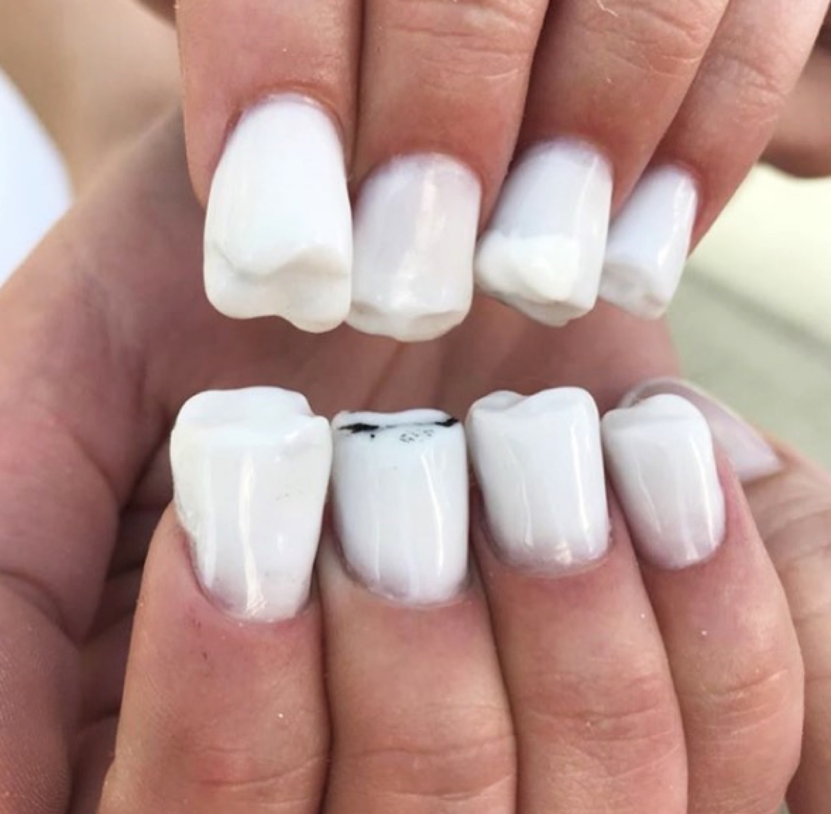 tooth nails