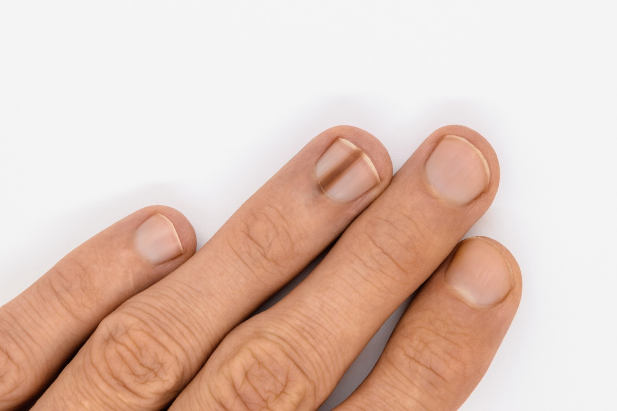 50 Surprising Symptoms And What They Mean Best Life