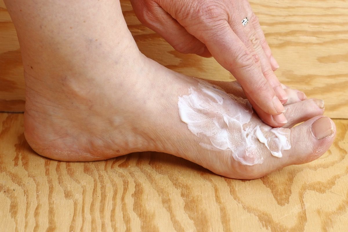 Woman Using Foot Cream For a Fungal Infection Silent Health Symptoms