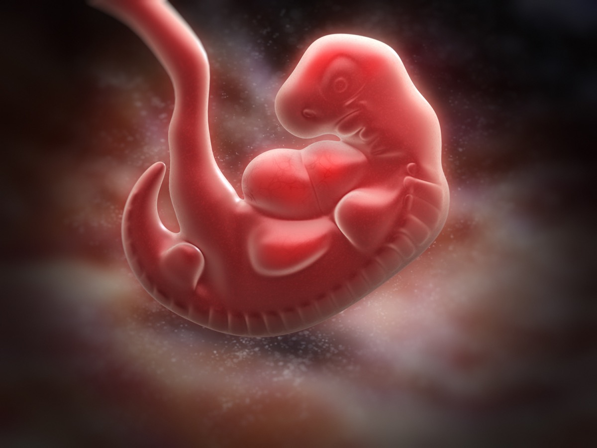 a fetus at 6 months old with a tail