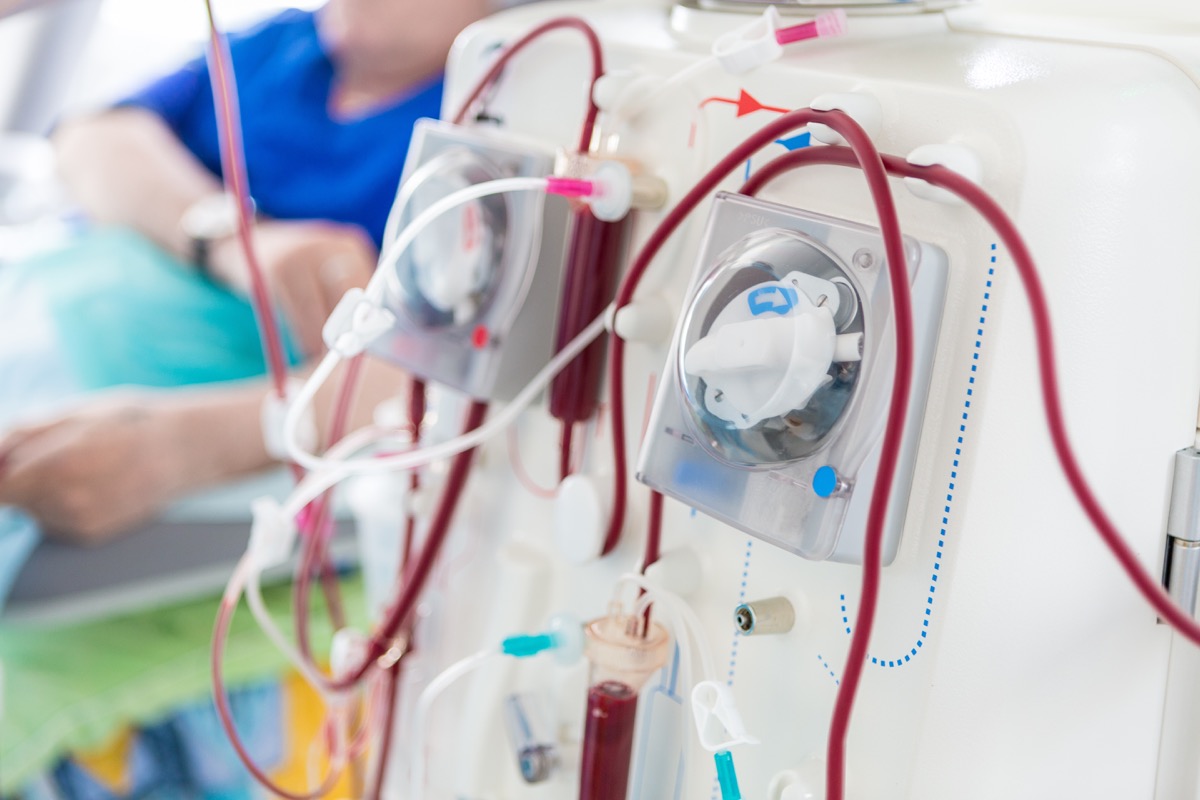 Man in the Hospital on Dialysis Misdiagnosed Men's Health Issues