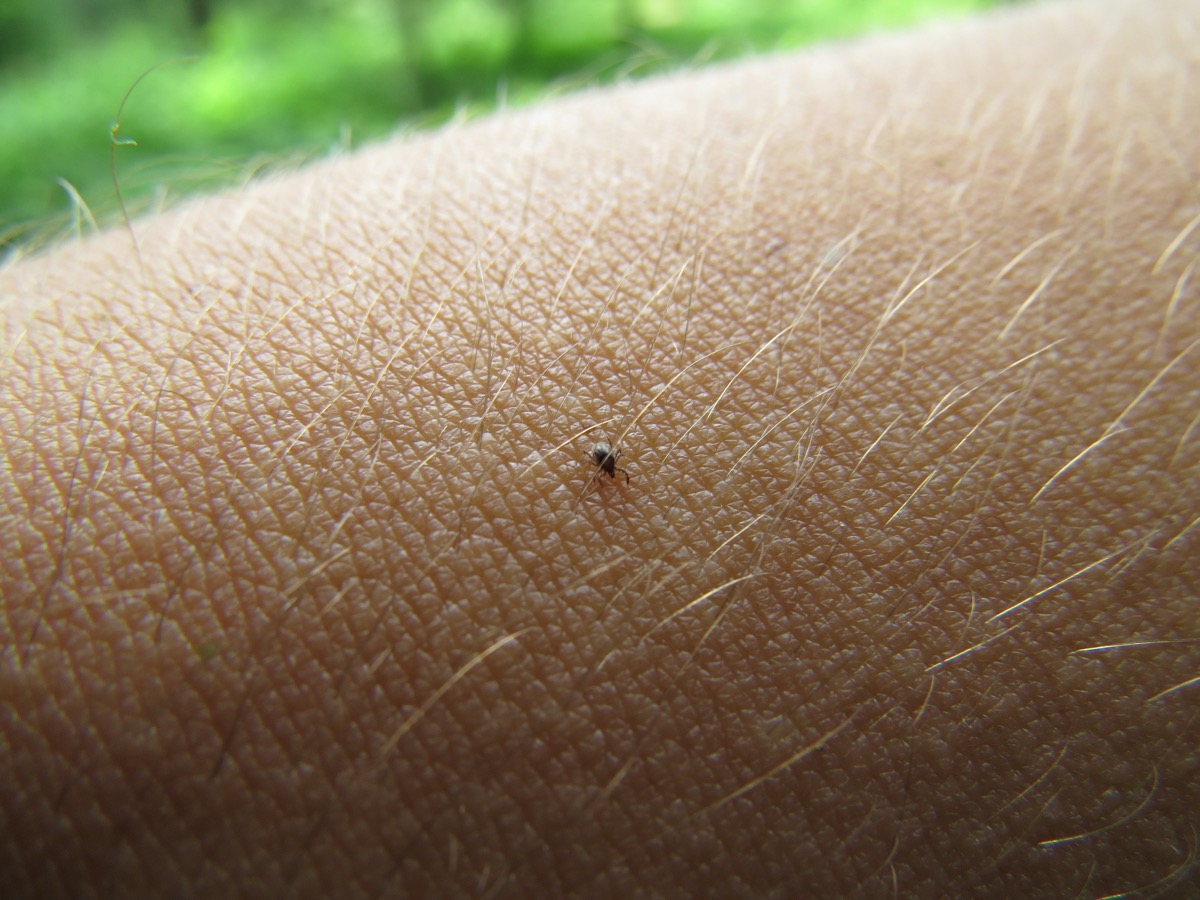 Tick crawling up a person's arm