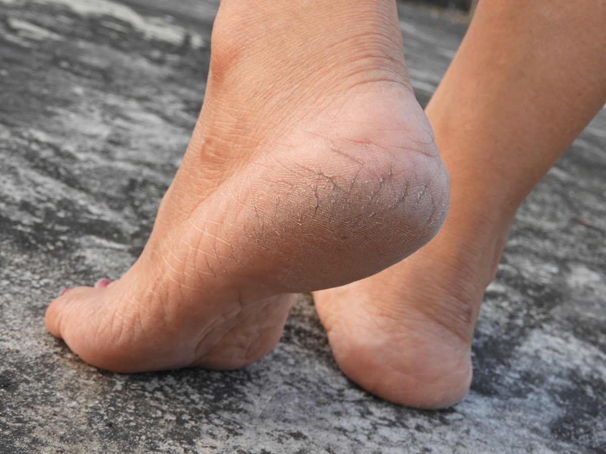 21 Foot Symptoms That Indicate Bigger Health Problems