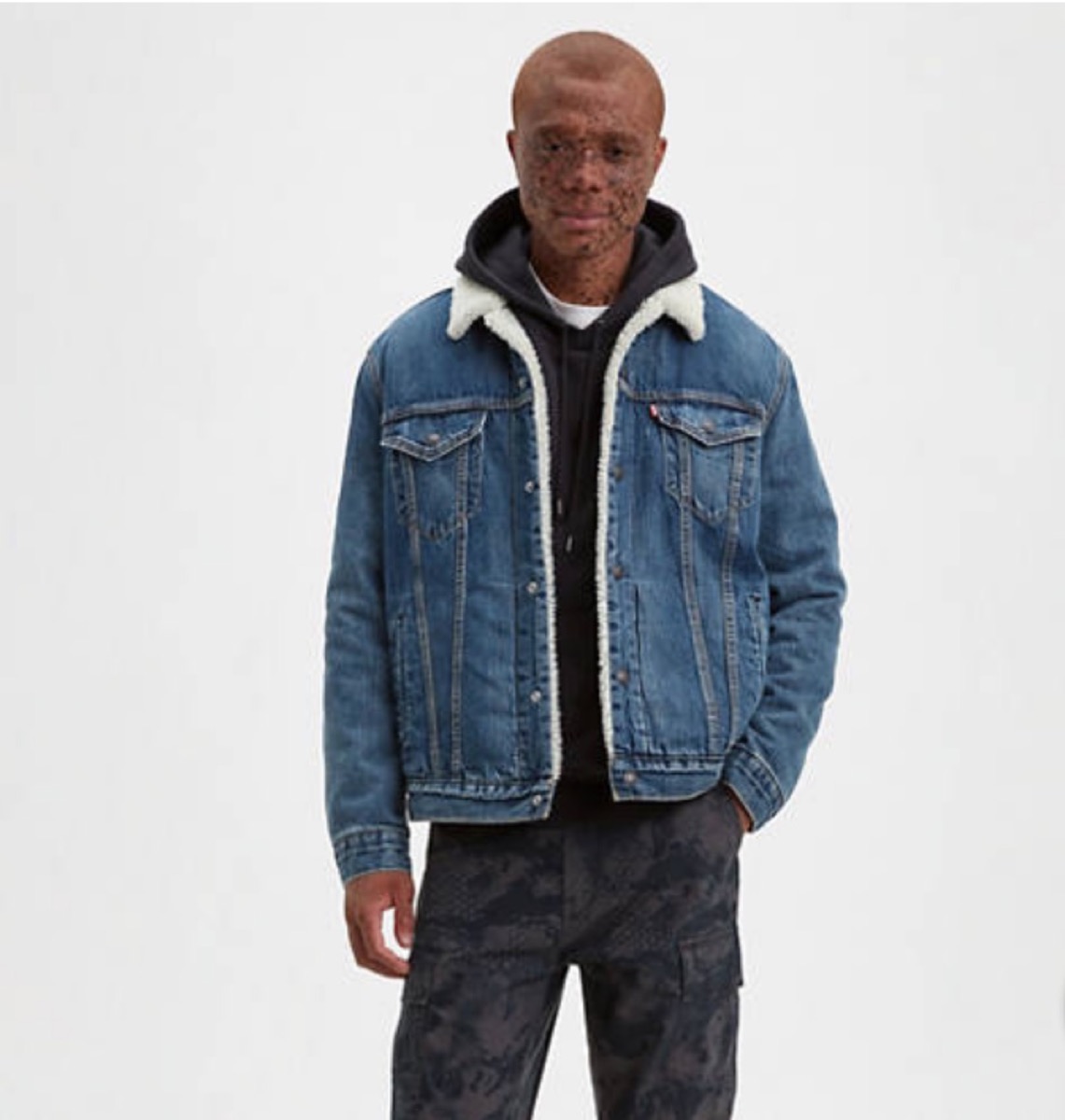 black man with freckles in denim jacket with fuzzy white collar and gray pants