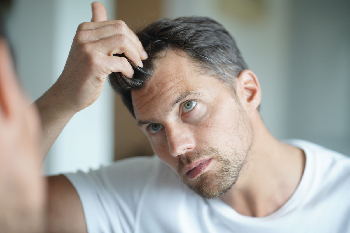 Man with thinning hair