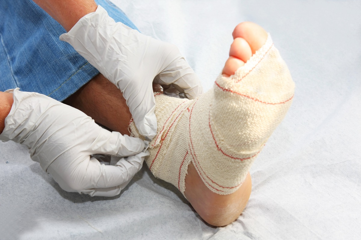 Doctor bandaging up a wounded foot