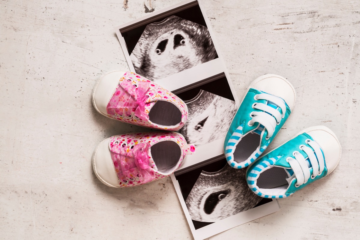 Ultrasound pics of twins and two sets of baby shoes 