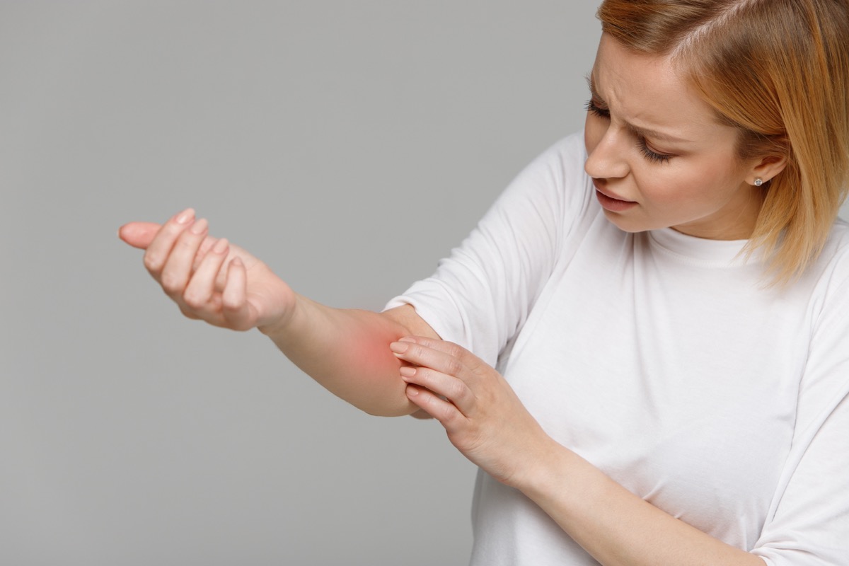 Woman looking at the red inflamed skin on her arm