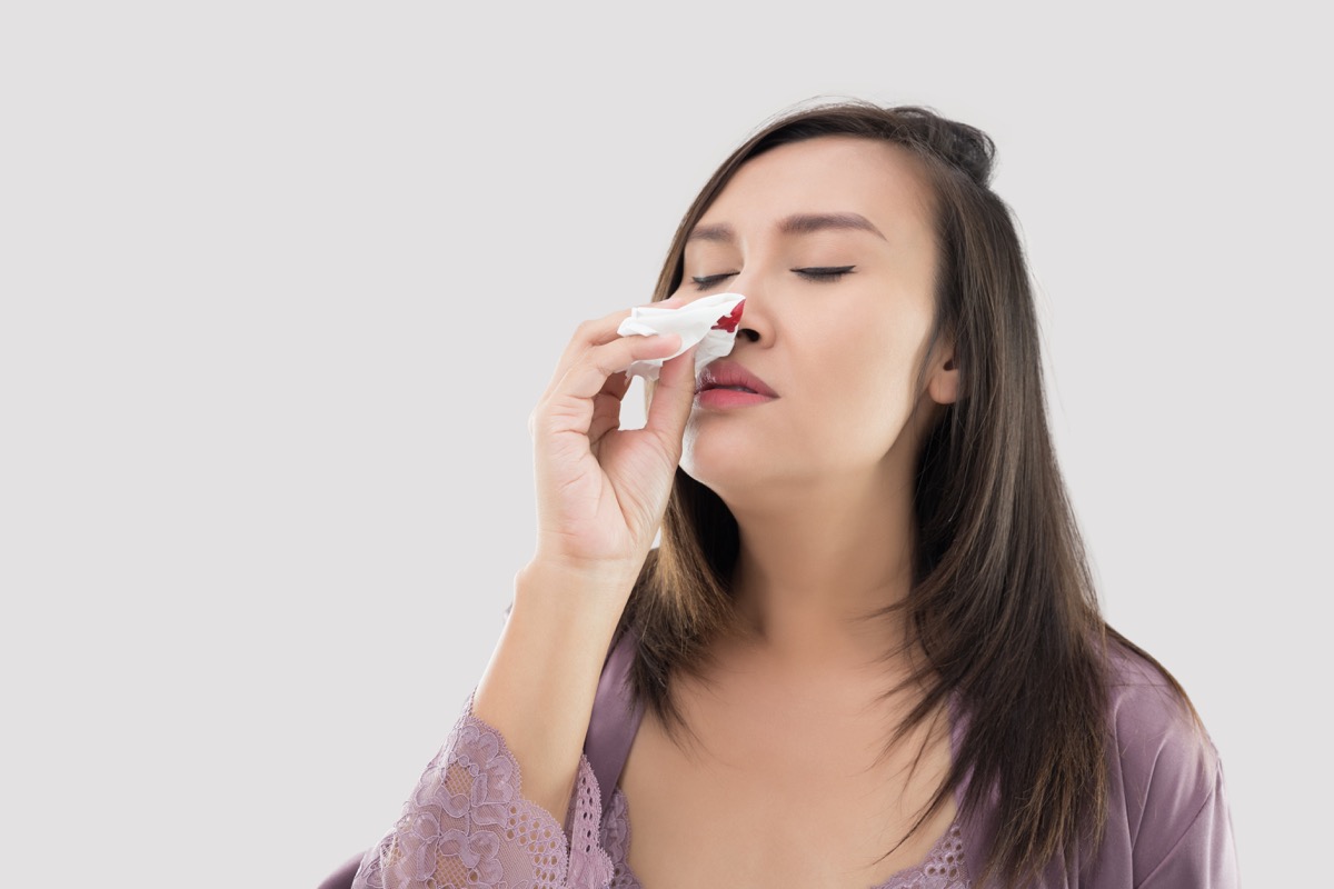 woman holding a tissue to her bleeding nose