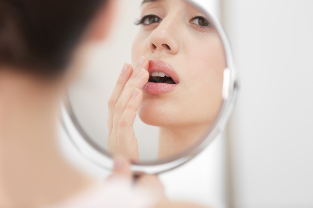 young woman with cold sore looking in mirror at home