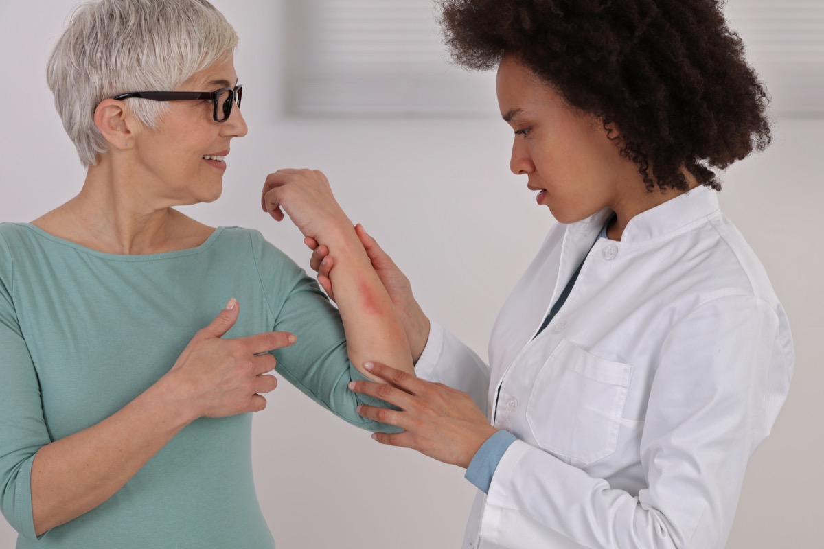 Female patient showing a doctor her arm rash