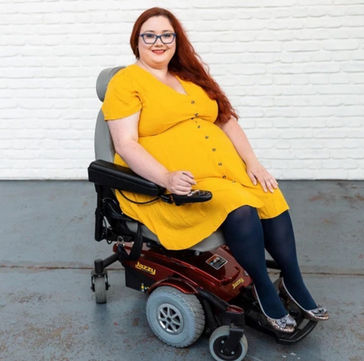 young woman in wheelchair wearing yellow dress and black tights