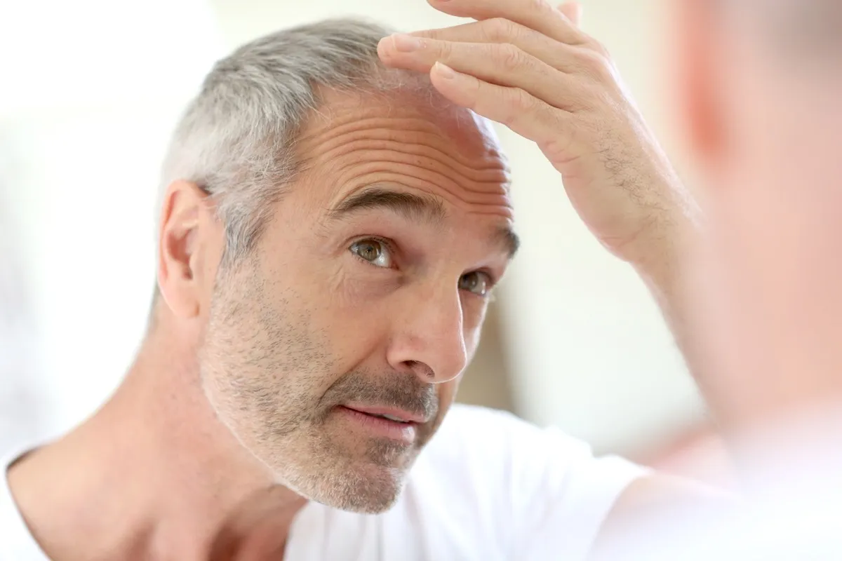 Man looking at hair loss