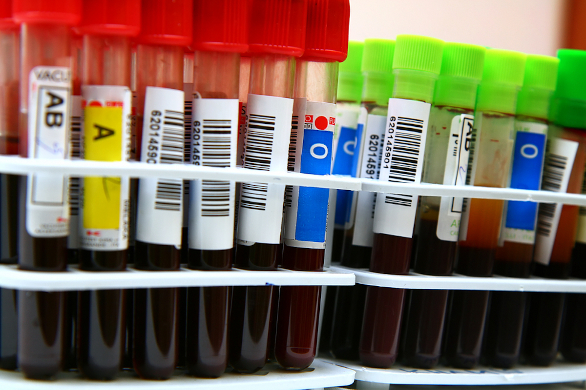 vials of blood show different blood types
