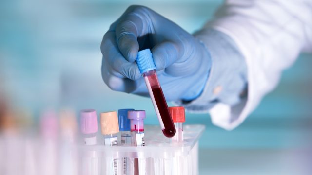 Gloved scientist hand holding blood tests