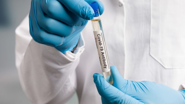 A lab technician wearing blue gloves holds test tubes with coronavirus antibody test samples