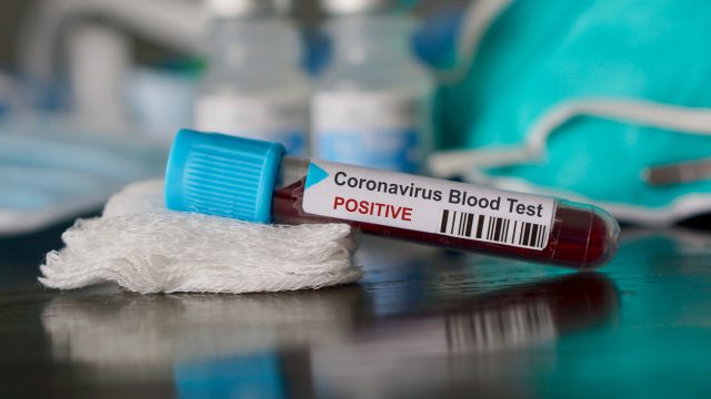 A vile holding a blood sample for a positive coronavirus patient