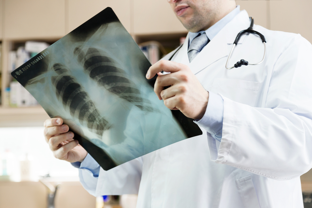 A doctor examines a chest x-ray film