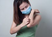 young woman scratching arm while wearing surgical mask