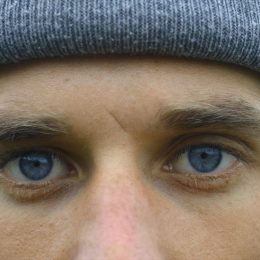 Closeup man with blue eyes and small scar