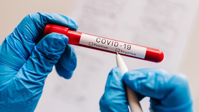 The glove-covered hands of doctor, nurse, or scientist writing with a pen on a vial of a covid test, confirming a negative result