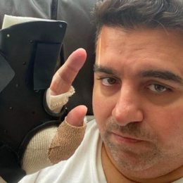 Cake Boss hand surgery