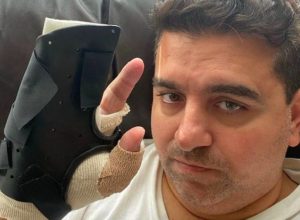Cake Boss hand surgery