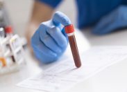 New $3 Blood Test Can Detect Cancer
