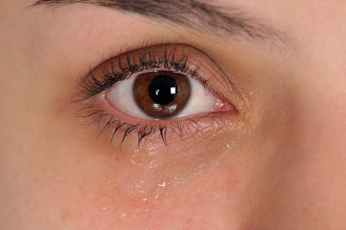 woman with watering eyes or tears