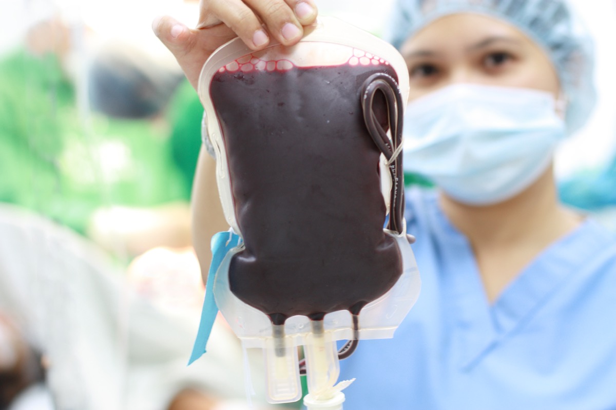 nurse holding a fresh donor blood for transfusion.narrow DOF