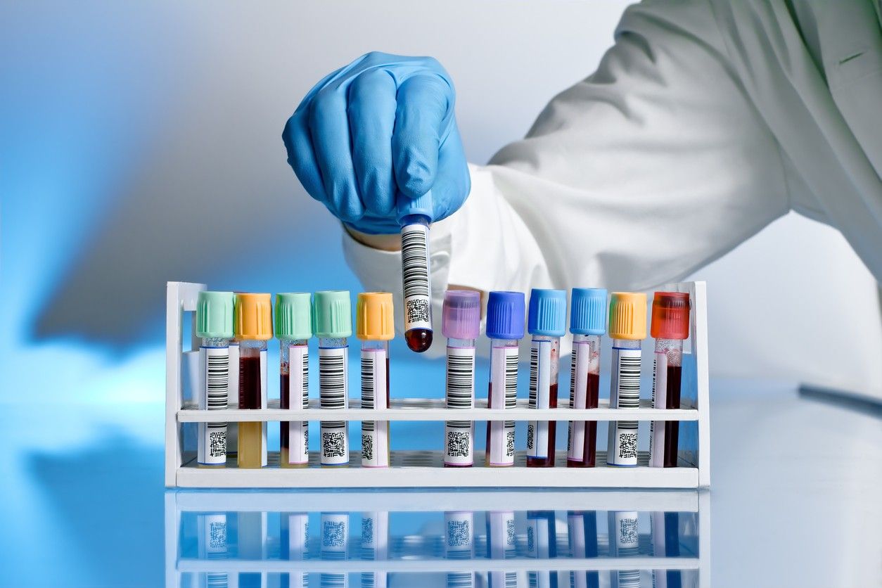 A medical technician wearing a glove picks up a vial of a blood sample from a rack