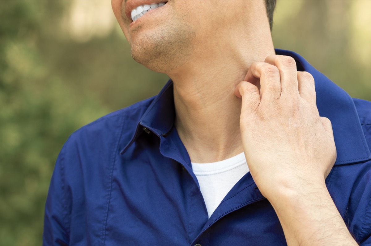 Close-up of man suffering itching scratching neck standing outdoors in a park